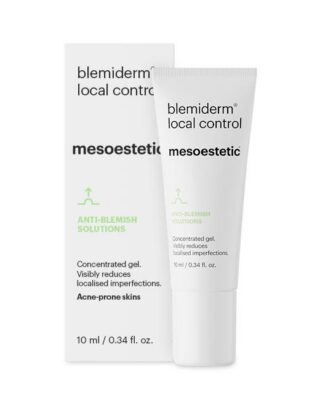 imperfection control